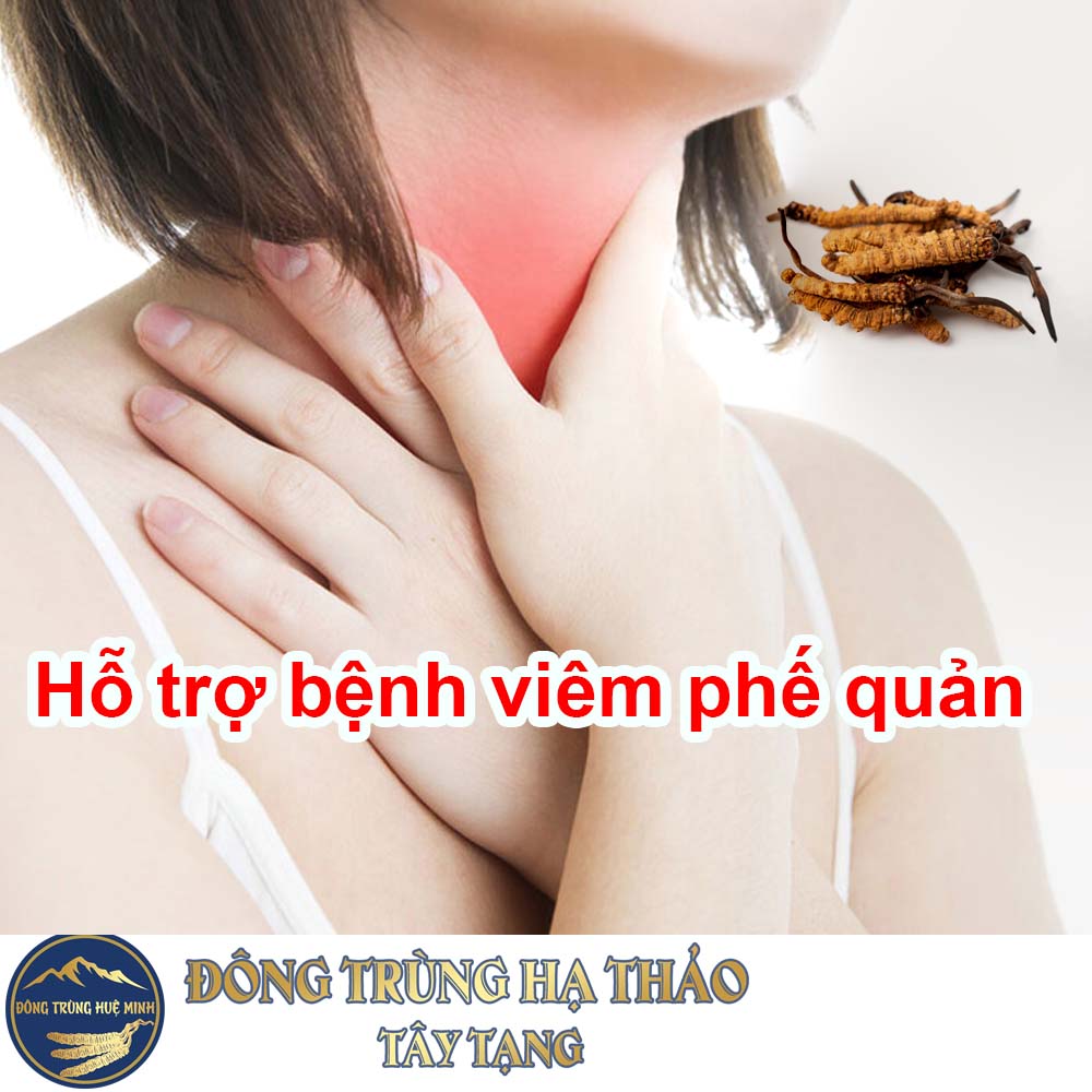 Đông trùng hạ thảo hỗ trợ bệnh viêm phế quản mãn tính Đông trùng hạ thảo hỗ trợ bệnh viêm phế quản mãn tính